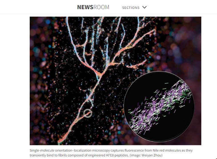 圣路易斯華盛頓大學開發出新型成像技術.png 圣路易斯華盛頓大學開發出新型成像技術.png